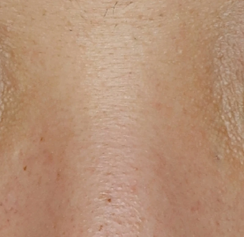 before_image