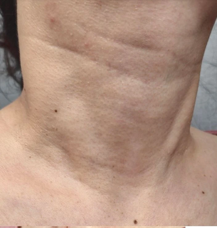 before_image