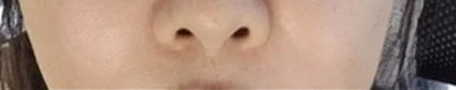 before_image