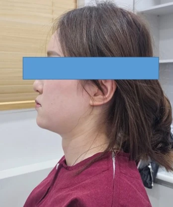 before_image