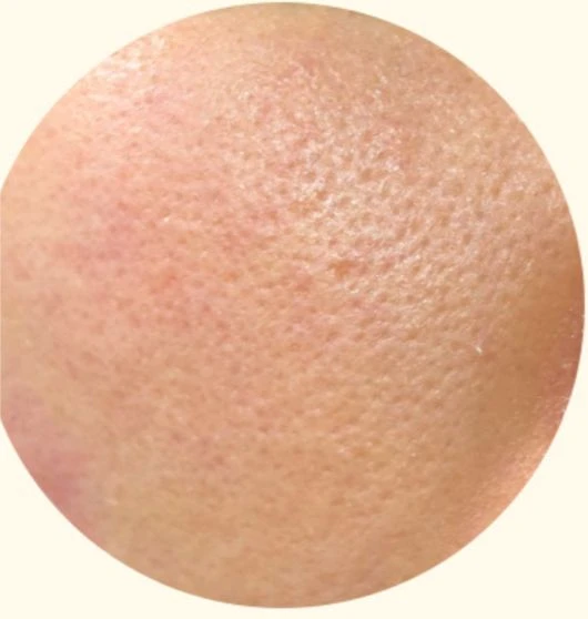 before_image