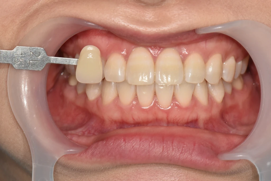 before_image