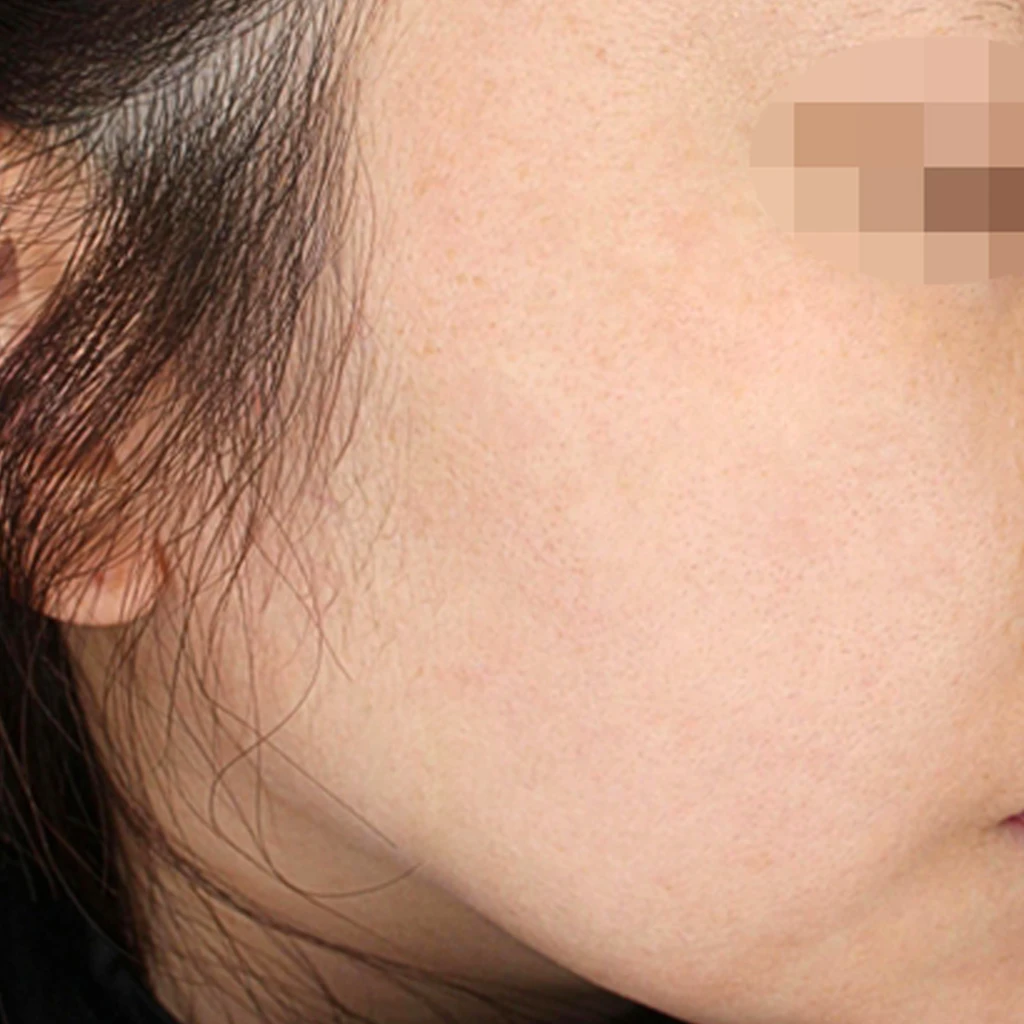before_image