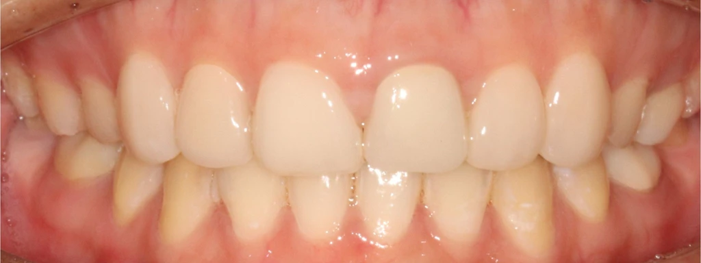 before_image
