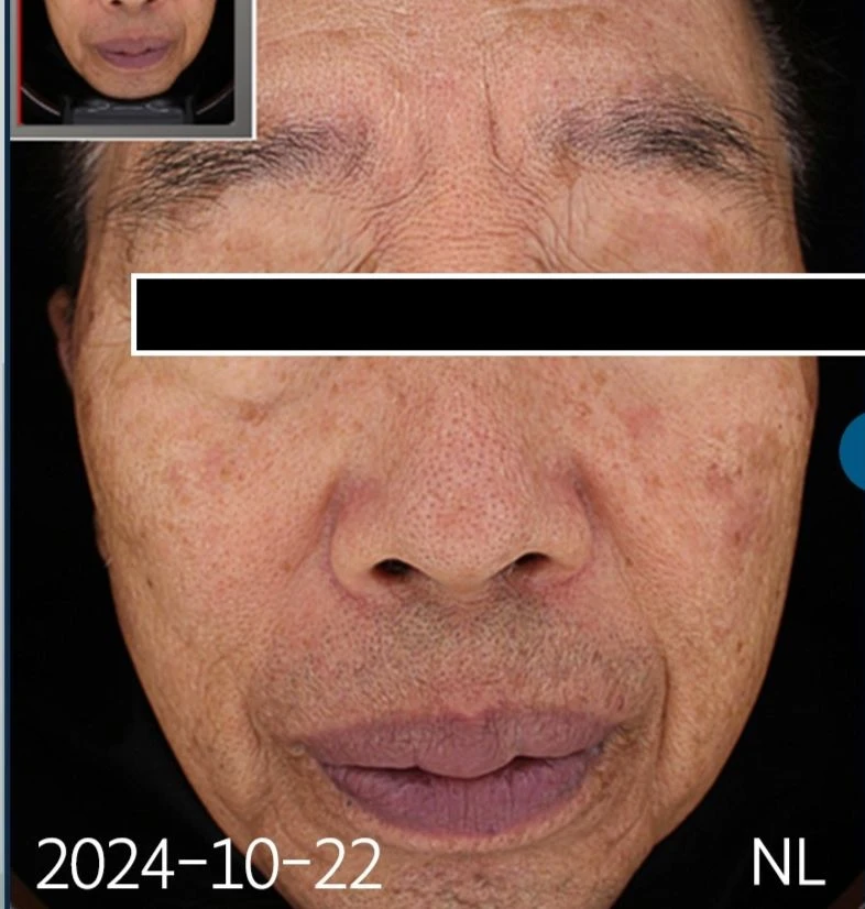 before_image