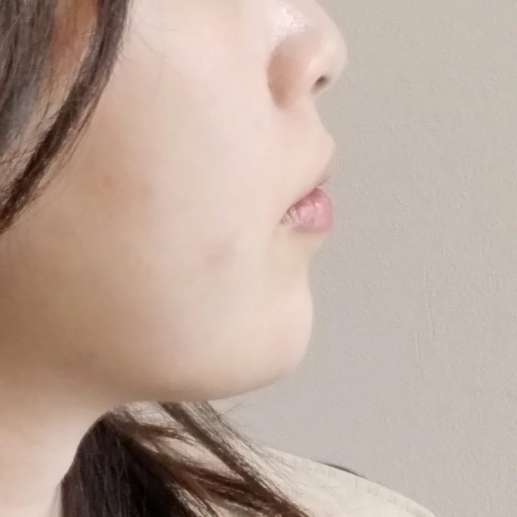 before_image