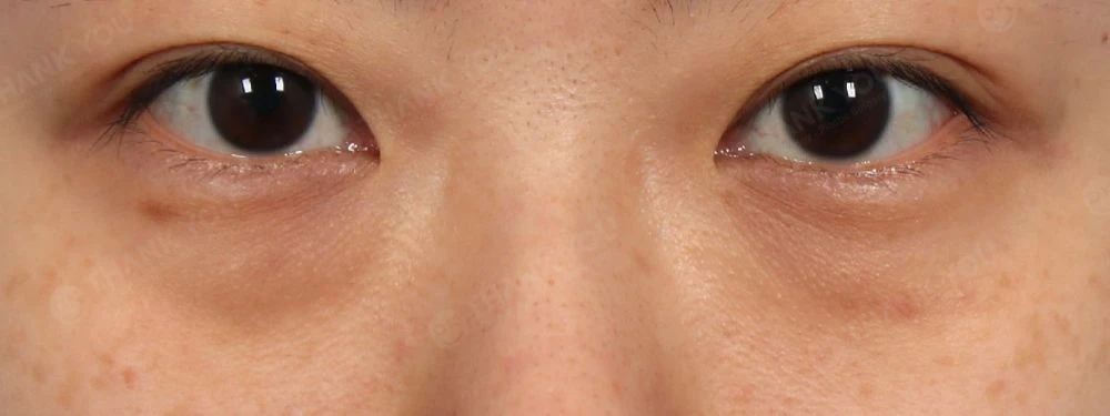 before_image