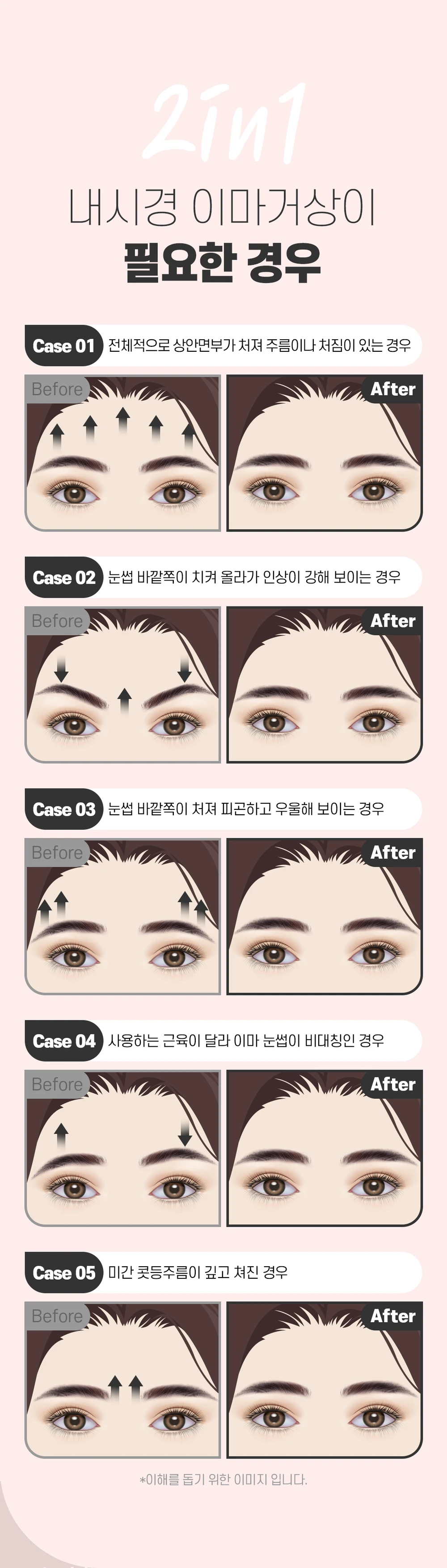treatmentIntroduction