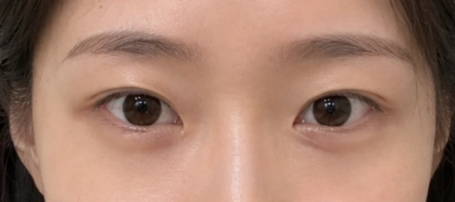 before_image