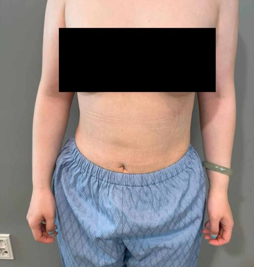 before_image