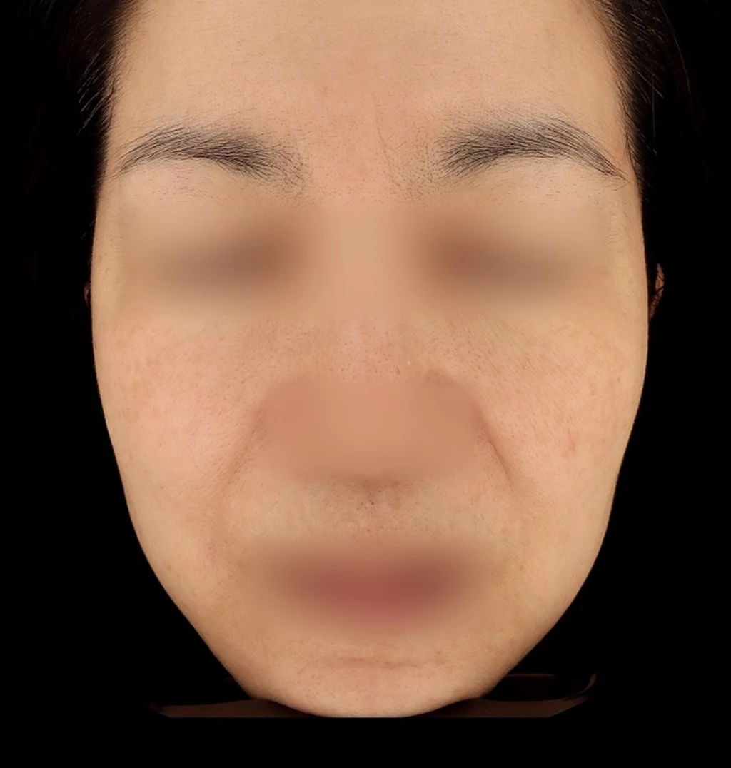 before_image