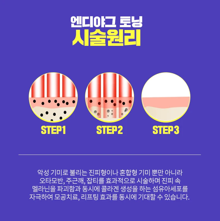 treatmentIntroduction