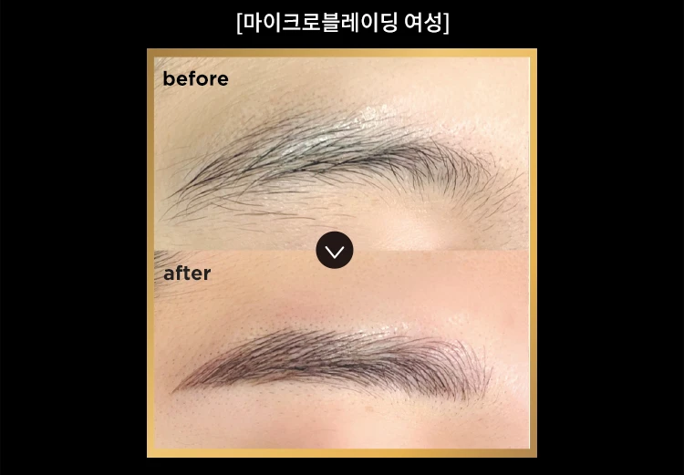 before_image