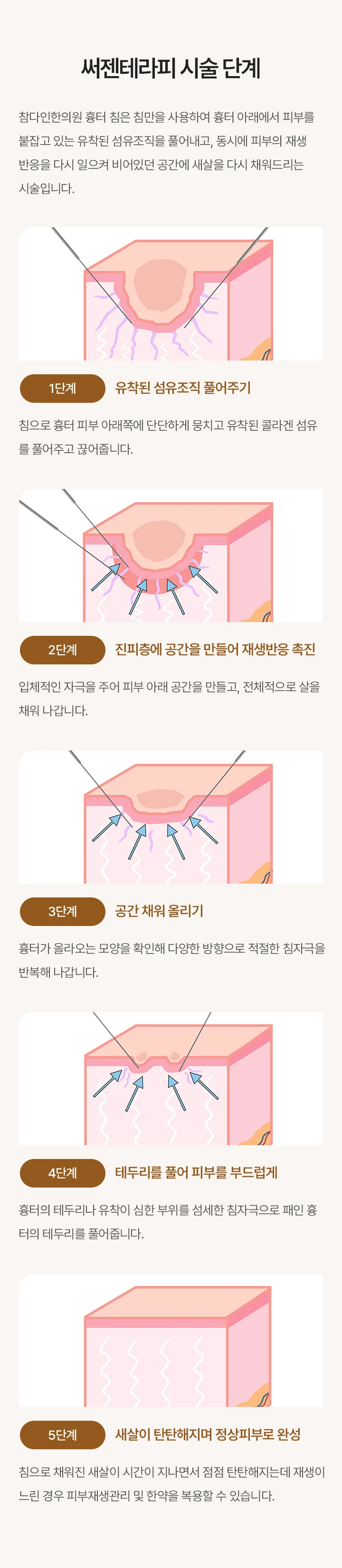 treatmentIntroduction