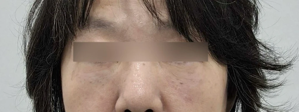 before_image