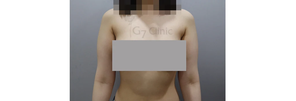 before_image