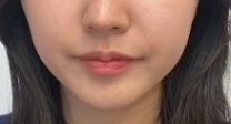before_image