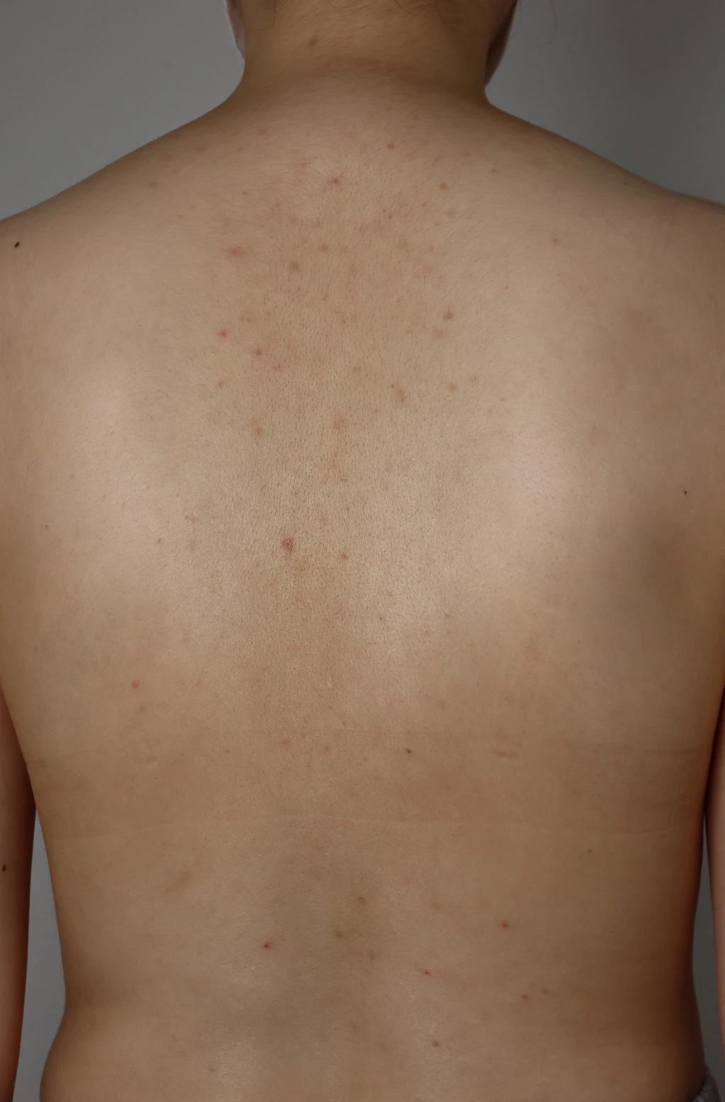before_image
