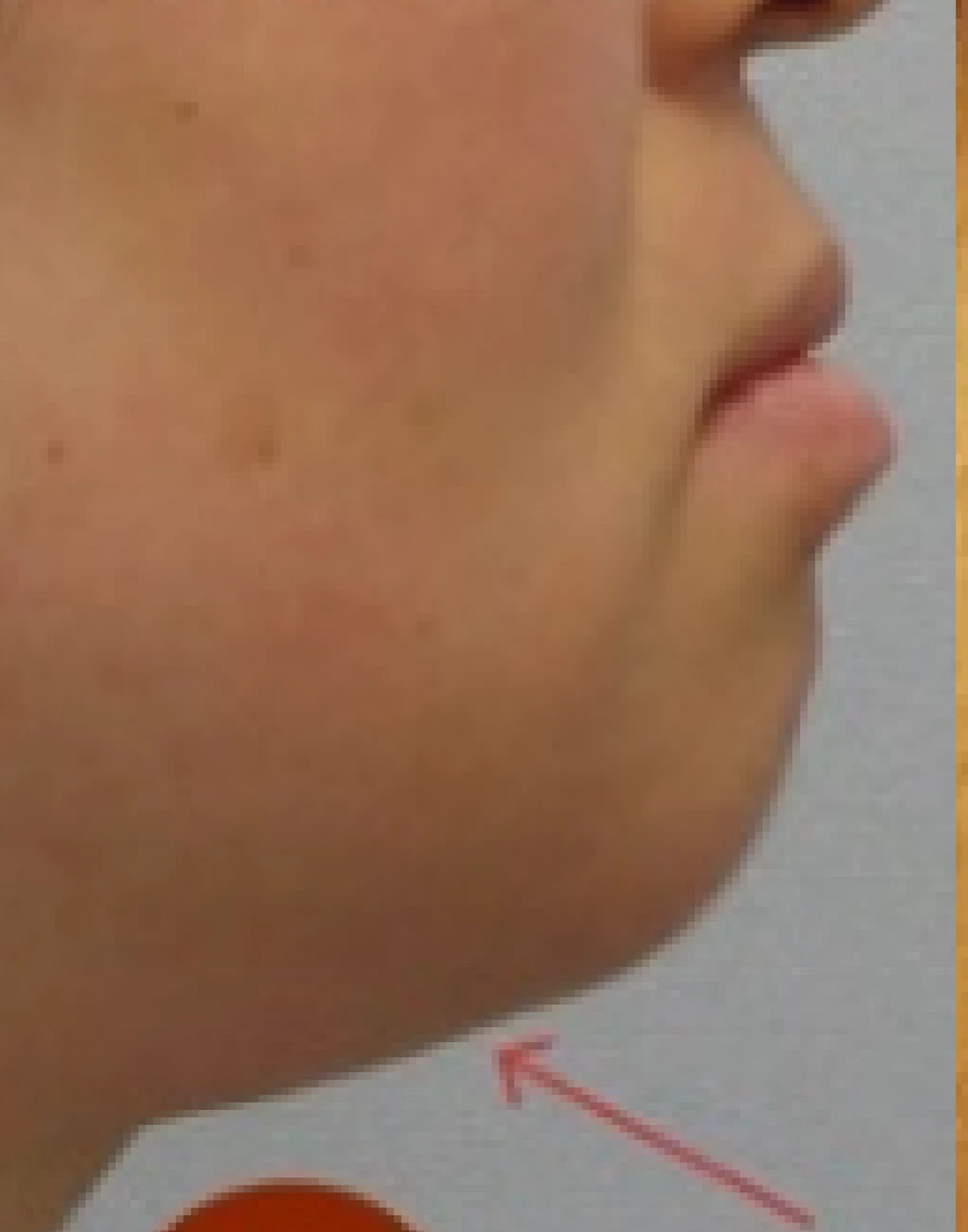 before_image