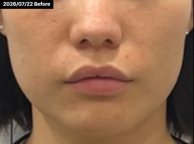 before_image
