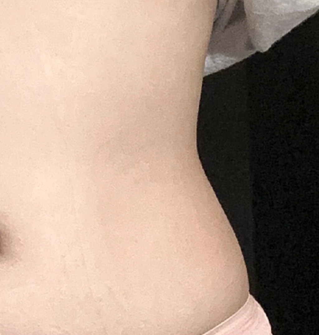 before_image