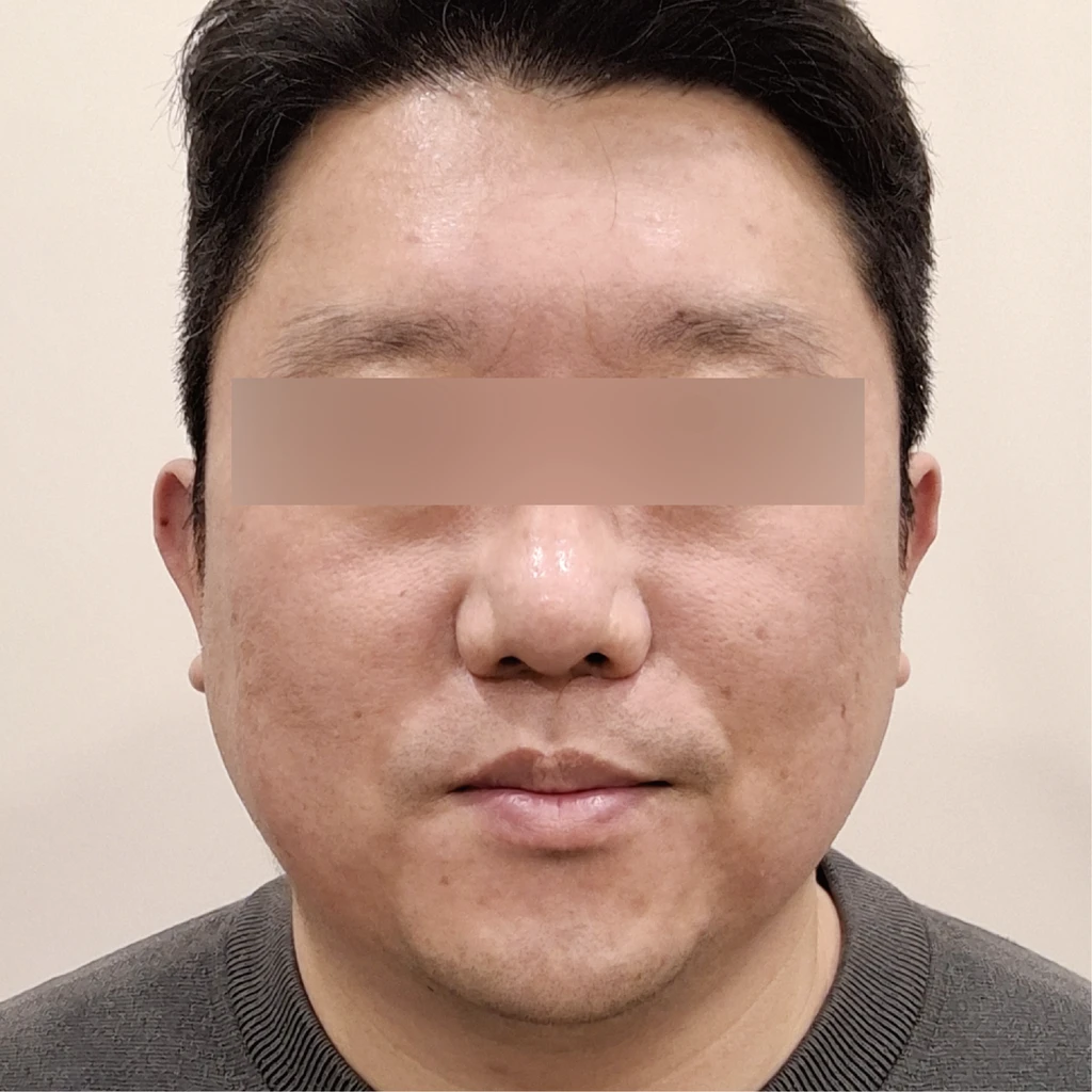 before_image
