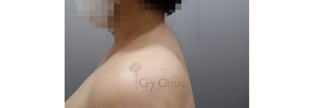 before_image