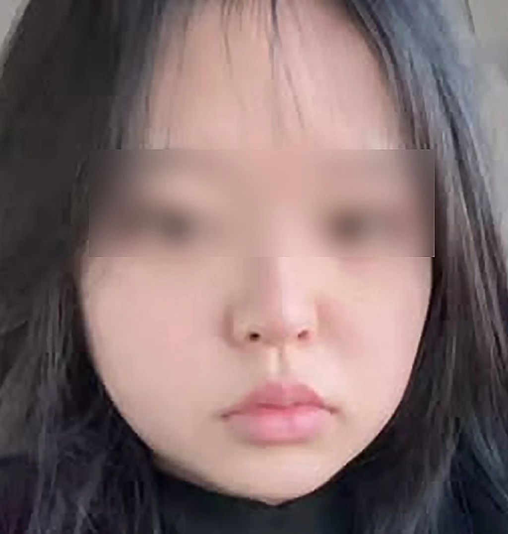 before_image