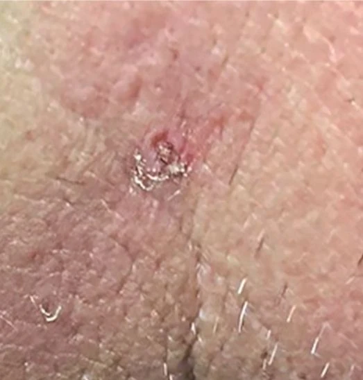 before_image