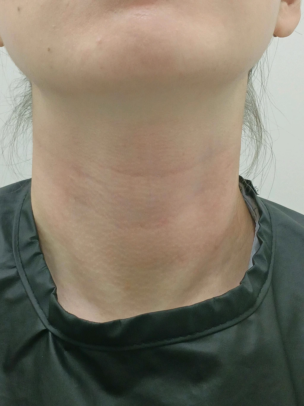 before_image