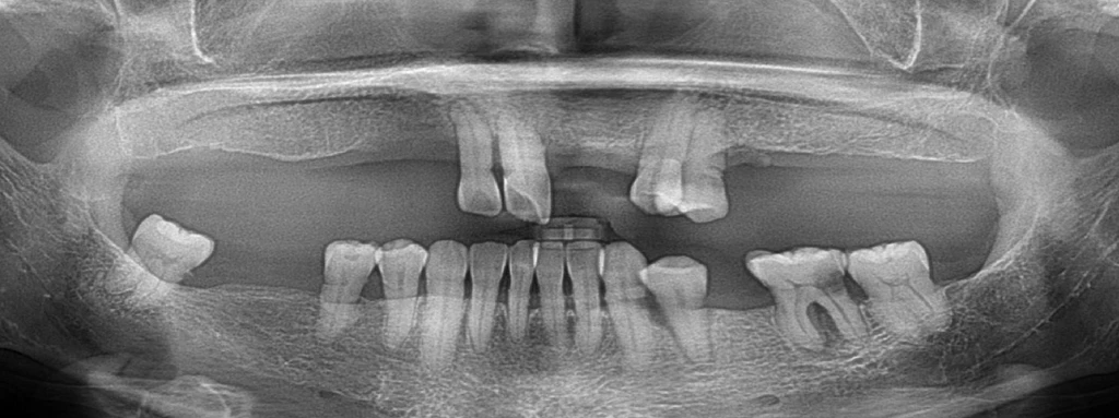 before_image