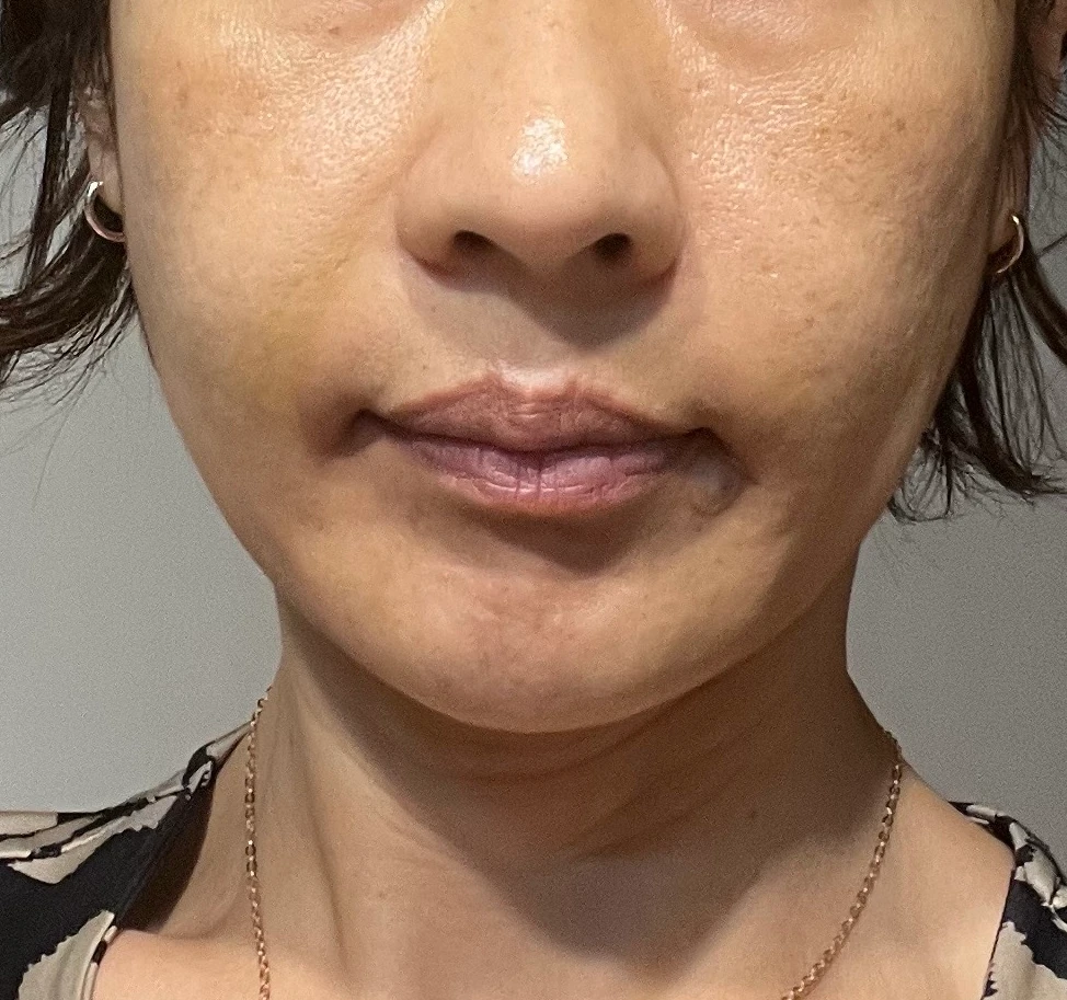 before_image