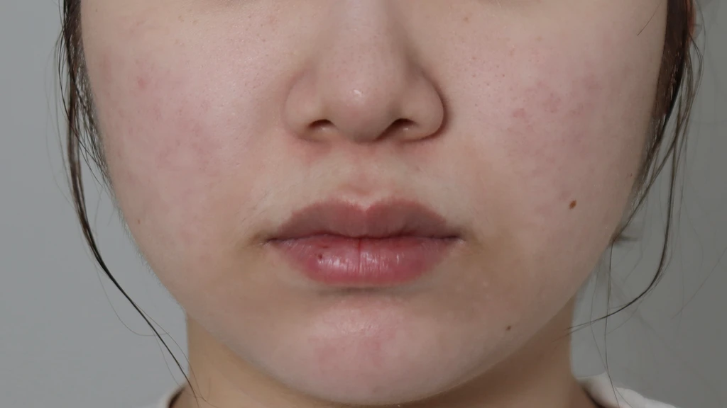 before_image