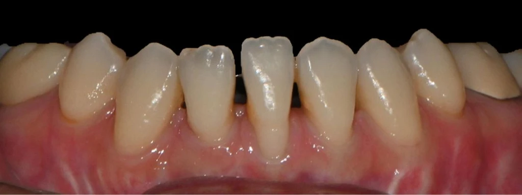 before_image