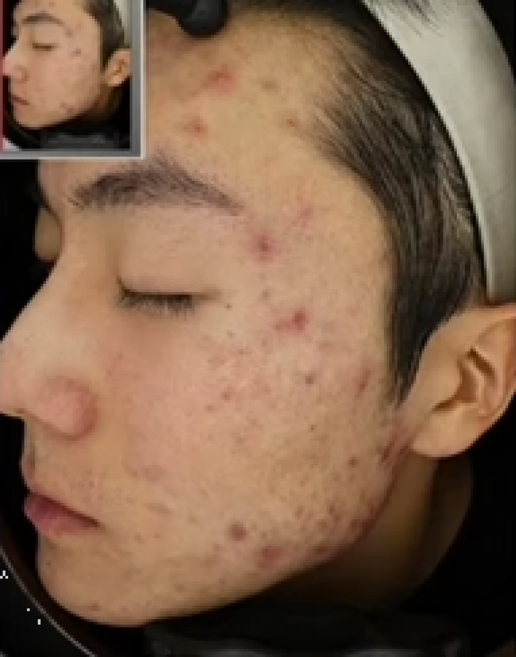 before_image