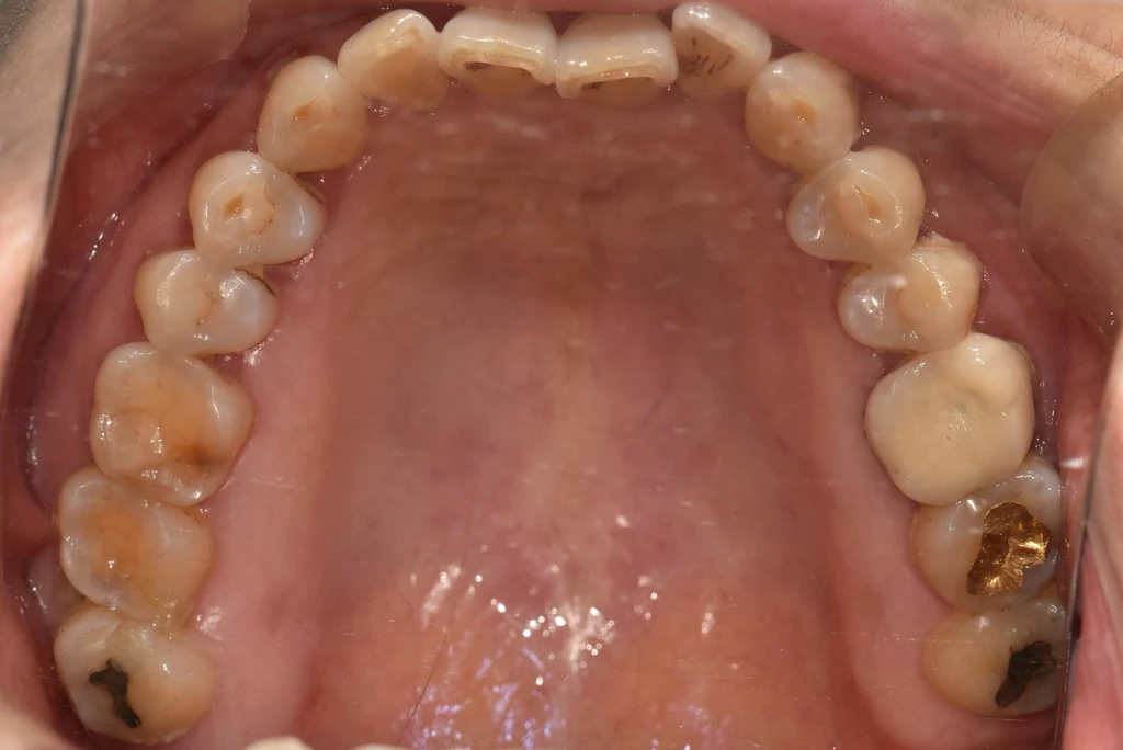before_image