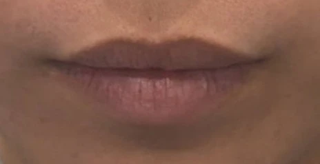 before_image