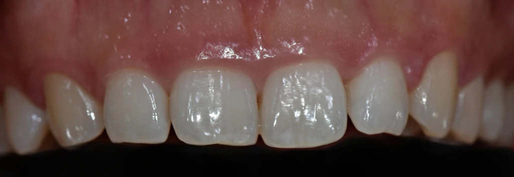 before_image