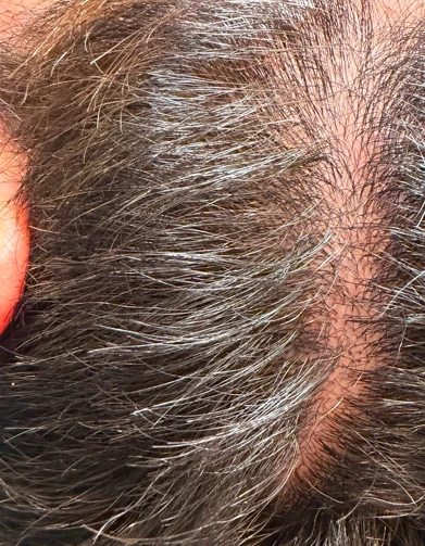 before_image