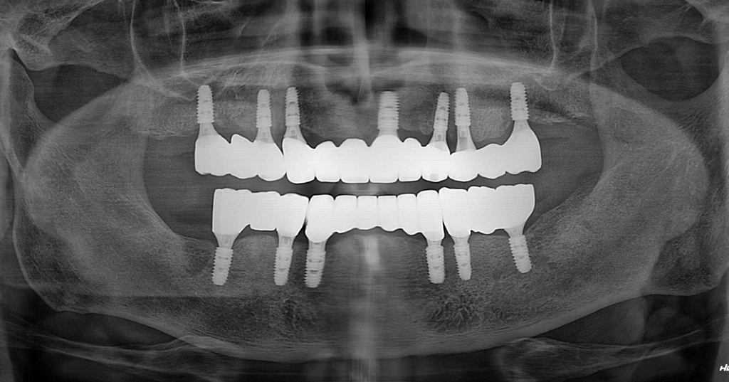 before_image