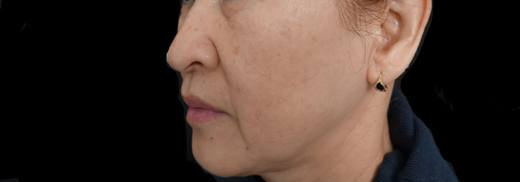 before_image