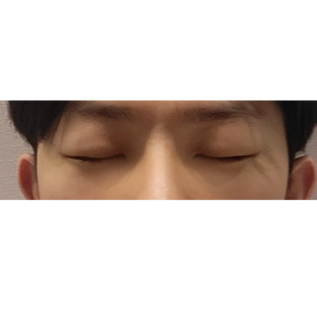 before_image