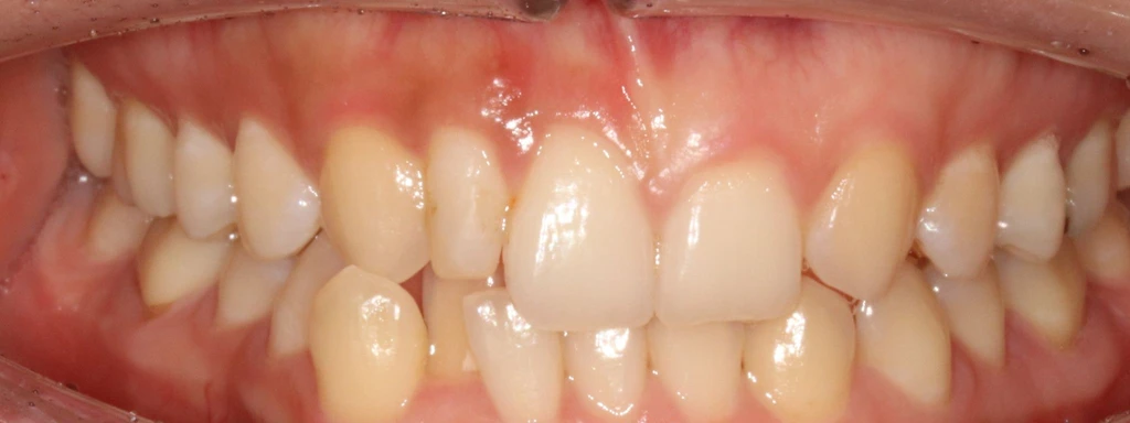 before_image