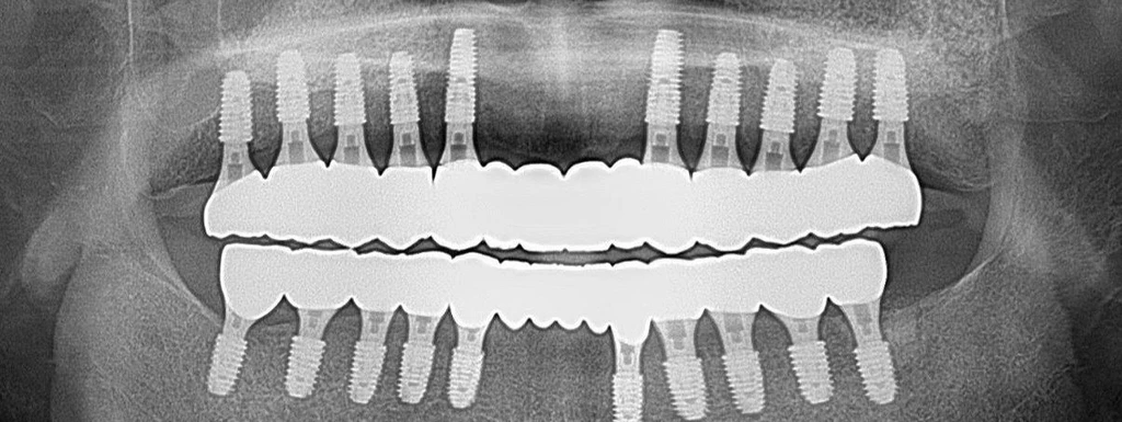 before_image