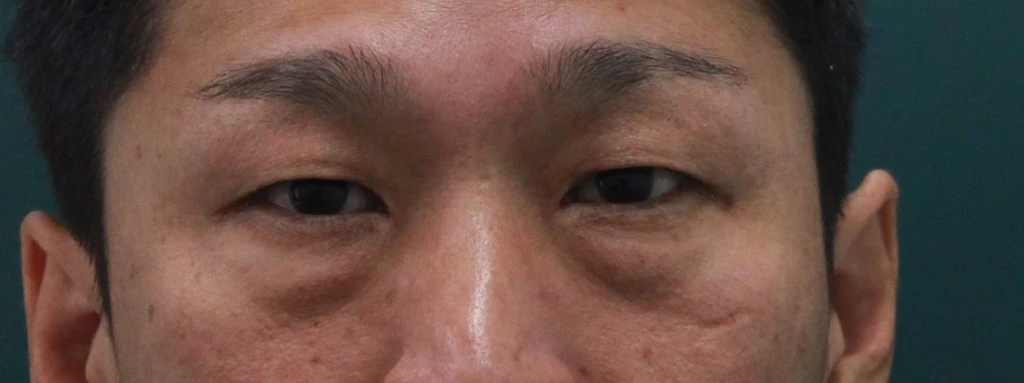 before_image