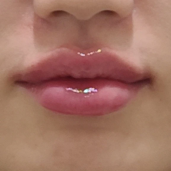before_image