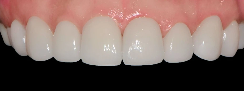 before_image