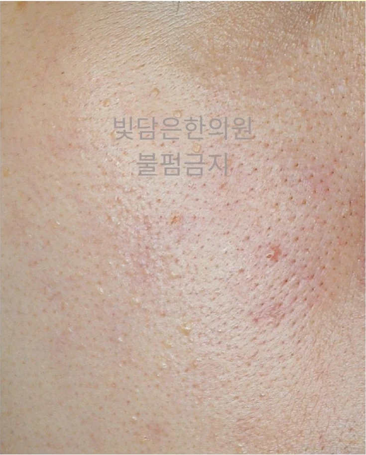 before_image