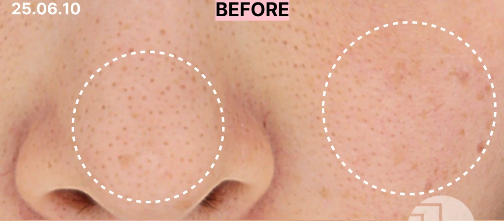 before_image