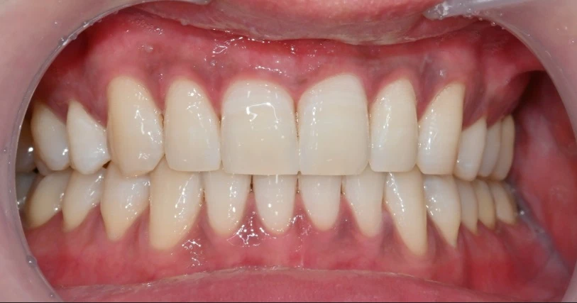 before_image